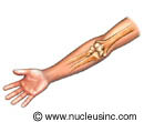 Bones of the elbow Bones of the elbow