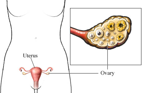 Ovary