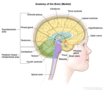 Drawing of the inside of the brain showing the supratentorial area (the upper part of the brain) and the posterior fossa/infratentorial area (the lower back part of the brain). The supratentorial area contains the cerebrum, lateral ventricle, third ventricle, choroid plexus, hypothalamus, pineal gland, pituitary gland, and optic nerve. The posterior fossa/infratentorial area contains the cerebellum, tectum, fourth ventricle, and brain stem (pons and medulla). The tentorium and spinal cord are also shown.