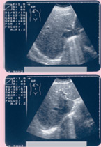 Echo image